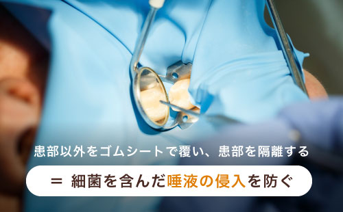 患部以外をゴムシートで覆い、患部を隔離する=細菌を含んだ唾液の浸入を防ぐ